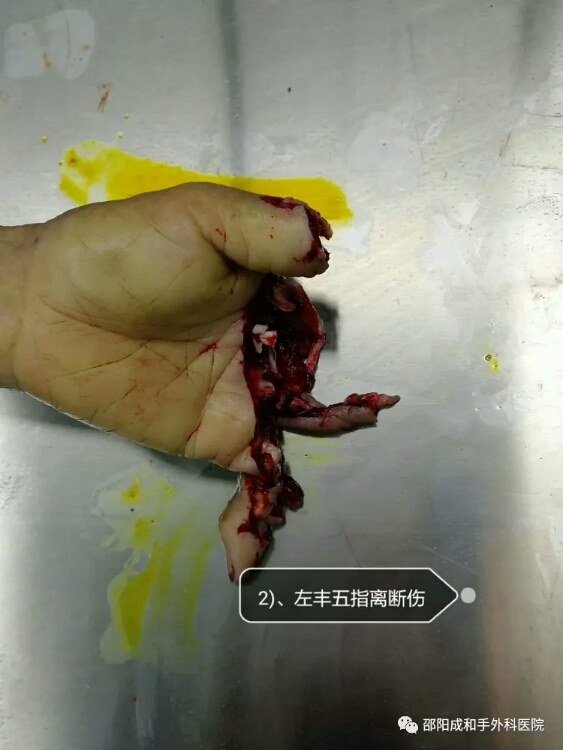 邵陽(yáng)創(chuàng  )傷骨科,邵陽(yáng)風(fēng)濕病區,邵陽(yáng)骨質(zhì)增生,邵陽(yáng)關(guān)節病區,邵陽(yáng)頸椎病區
