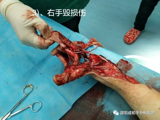 邵陽(yáng)創(chuàng  )傷骨科,邵陽(yáng)風(fēng)濕病區,邵陽(yáng)骨質(zhì)增生,邵陽(yáng)關(guān)節病區,邵陽(yáng)頸椎病區