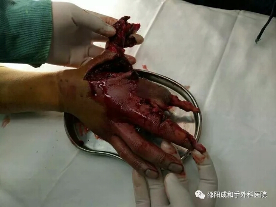 邵陽(yáng)創(chuàng  )傷骨科,邵陽(yáng)風(fēng)濕病區,邵陽(yáng)骨質(zhì)增生,邵陽(yáng)關(guān)節病區,邵陽(yáng)頸椎病區