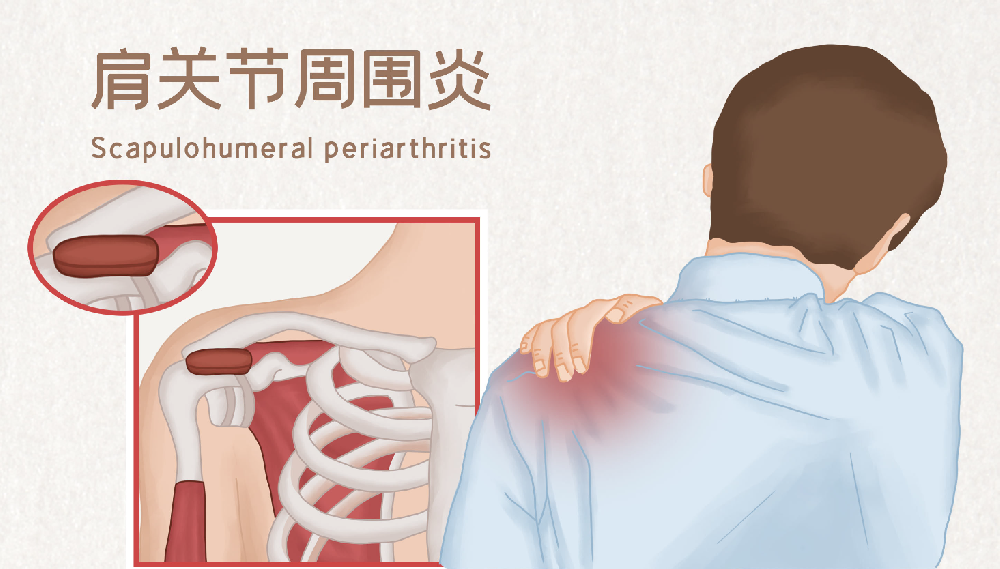 邵陽(yáng)創(chuàng )傷骨科,邵陽(yáng)風(fēng)濕病區,邵陽(yáng)骨質(zhì)增生,邵陽(yáng)關(guān)節病區,邵陽(yáng)頸椎病區 邵陽(yáng)創(chuàng )傷骨科,邵陽(yáng)風(fēng)濕病區,邵陽(yáng)骨質(zhì)增生,邵陽(yáng)關(guān)節病區,邵陽(yáng)頸椎病區