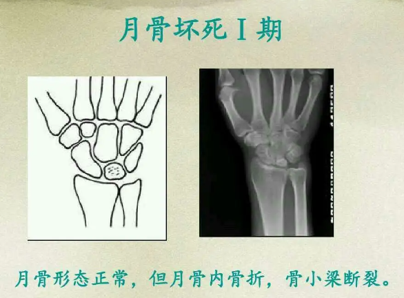 邵陽(yáng)創(chuàng  )傷骨科,邵陽(yáng)風(fēng)濕病區,邵陽(yáng)骨質(zhì)增生,邵陽(yáng)關(guān)節病區,邵陽(yáng)頸椎病區