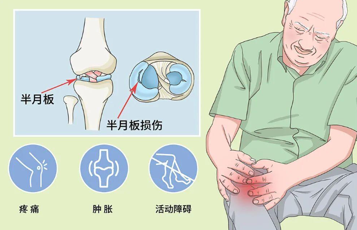 邵陽(yáng)創(chuàng  )傷骨科,邵陽(yáng)風(fēng)濕病區,邵陽(yáng)骨質(zhì)增生,邵陽(yáng)關(guān)節病區,邵陽(yáng)頸椎病區