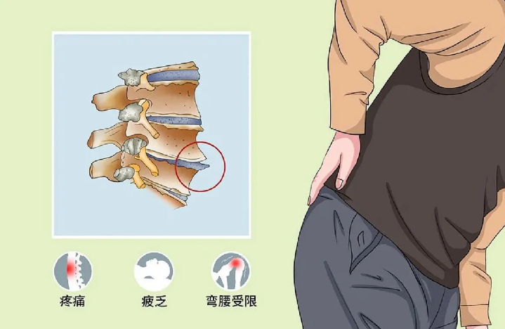 邵陽(yáng)創(chuàng  )傷骨科,邵陽(yáng)風(fēng)濕病區,邵陽(yáng)骨質(zhì)增生,邵陽(yáng)關(guān)節病區,邵陽(yáng)頸椎病區