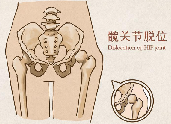 邵陽(yáng)創(chuàng  )傷骨科,邵陽(yáng)風(fēng)濕病區,邵陽(yáng)骨質(zhì)增生,邵陽(yáng)關(guān)節病區,邵陽(yáng)頸椎病區