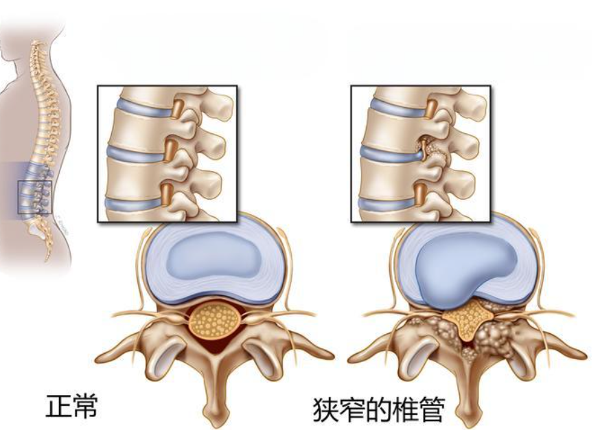 邵陽(yáng)創(chuàng  )傷骨科,邵陽(yáng)風(fēng)濕病區,邵陽(yáng)骨質(zhì)增生,邵陽(yáng)關(guān)節病區,邵陽(yáng)頸椎病區