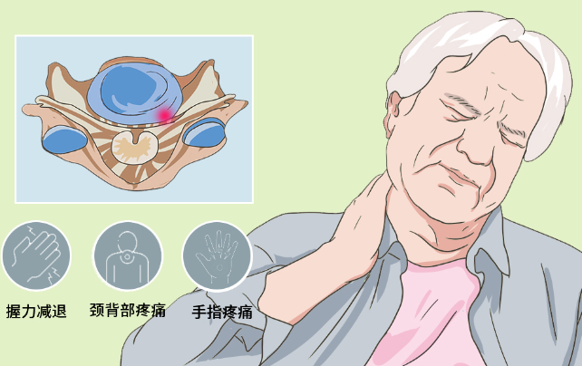 邵陽(yáng)創(chuàng  )傷骨科,邵陽(yáng)風(fēng)濕病區,邵陽(yáng)骨質(zhì)增生,邵陽(yáng)關(guān)節病區,邵陽(yáng)頸椎病區