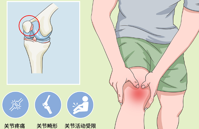 邵陽(yáng)創(chuàng  )傷骨科,邵陽(yáng)風(fēng)濕病區,邵陽(yáng)骨質(zhì)增生,邵陽(yáng)關(guān)節病區,邵陽(yáng)頸椎病區